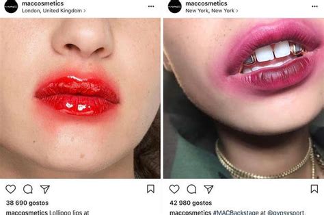 Super Glue Lips Trend