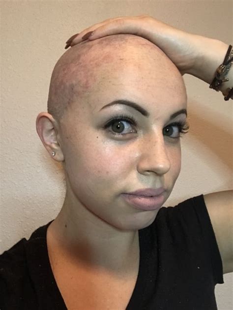 What Happened After I Shaved My Head Shave My Head Shave Her Head Bald Women