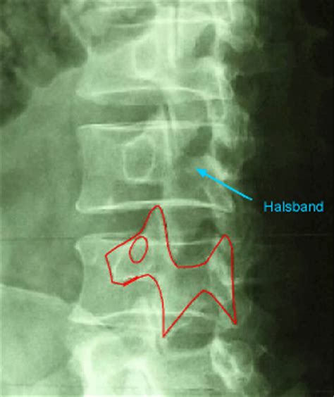 Eine hundefigur aus porzellan ca. Spondylolisthese