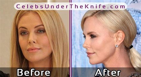 Charlize Theron Nose Job Photos Before After Plastic Surgery