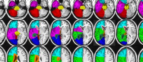 Neuroimaging Group Pipeline Centre For Healthy Brain Ageing Cheba