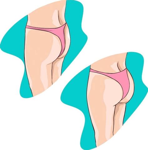 Types Of Butt Implants Back Surgery Fat Transfer Belvedere Clinic
