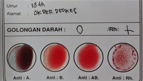 Urutan Golongan Darah Yang Paling Kuat Hingga Rentan Sakit Golongan A