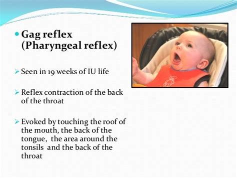 Gag Reflex Preventive Dentistry Reflexes Infant