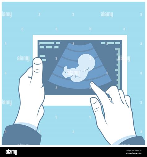 Embarazo Imágenes Vectoriales De Stock Alamy