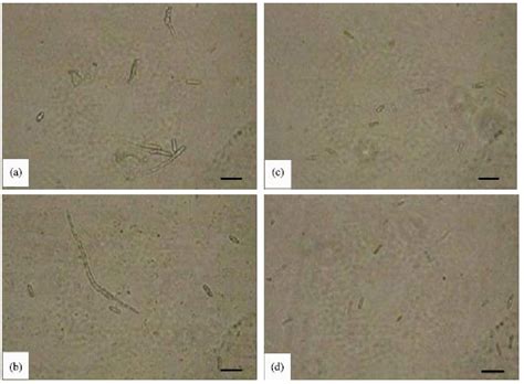 Antagonistic Effects Of Streptomyces Sp Srm1 On Colletotrichum Musae