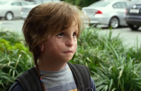 What Condition Does Auggie Have In Wonder The Heartbreaking Movie
