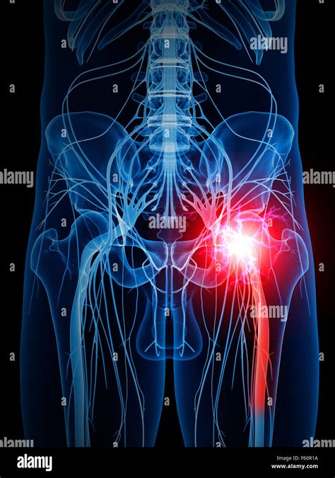 Sciatic Nerve X Ray Hi Res Stock Photography And Images Alamy