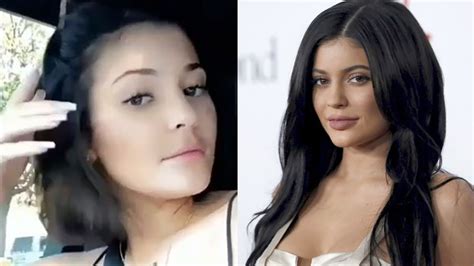 Kylie Jenner Reveals On Instagram She Removed Lip Filler Fox News