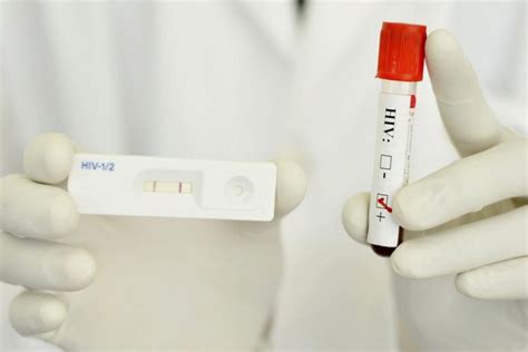 Testiranje Na Spolne Bolesti