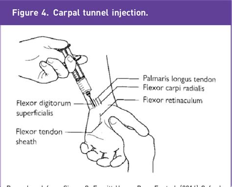 Figure 1 From Carpal And Cubital Tunnel Syndromes Semantic Scholar