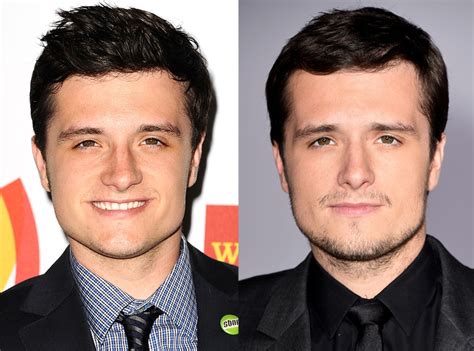 Josh Hutcherson From Celebrities Who Got A Nose Job To Fix Their