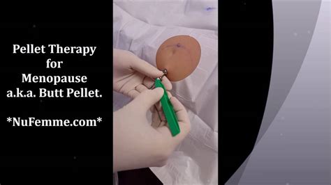 Watch A Hormone Pellet Insertion Procedure Pellet Therapy For Menopause Youtube
