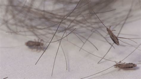 Lice Insects On Human Dyed Hair Clump Macro Stock Footage Sbv 337775180 Storyblocks