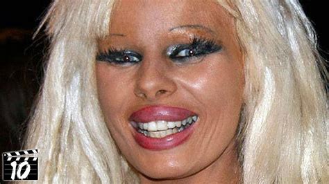 Top 10 Hollywood Celebrities Who Are Unrecognizable After Plastic