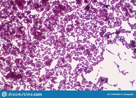Bacillus Gram Positive Stain Under Microscope View