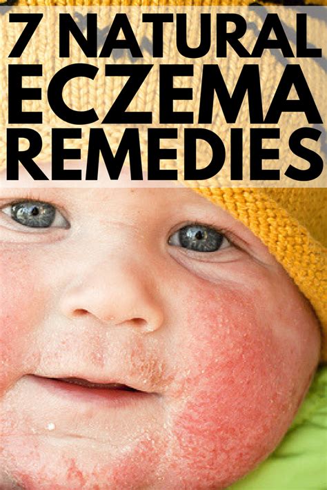 Ways To Counter Eczema In Kids Elliejobson