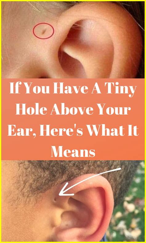 If You Have A Tiny Hole Above Your Ear Heres What It Means