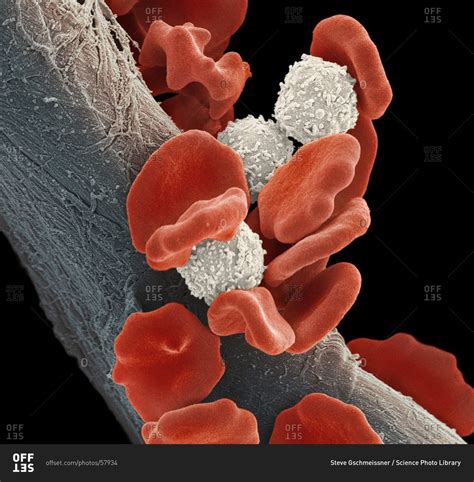 Leukemia Blood Cells Under A Color Scanning Electron Micrograph Red