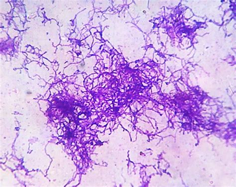 Grams Staining Showing Long Filamentous Branched Gram Positive