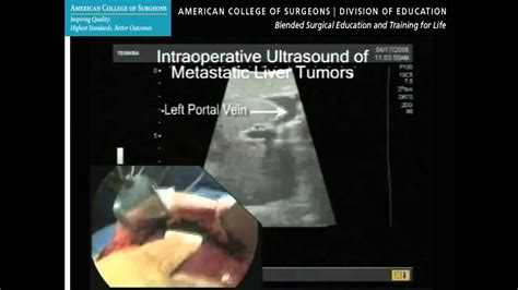 Ultrasound For Surgeons The Basic Course—clinical Example Abdomen