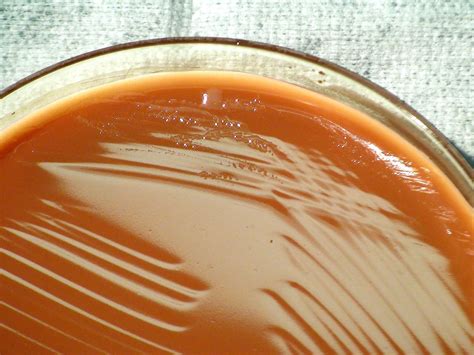 Free Picture Francisella Tularensis Bacteria Grown Chocolate Agar