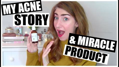 My Acne Story And Miracle Product Youtube