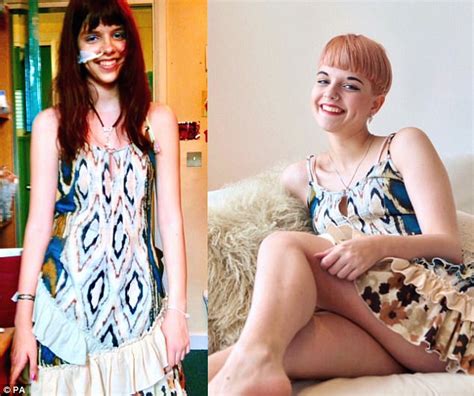 Recovering Anorexics Helps Others Using Social Media Daily Mail Online