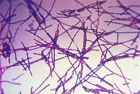 Filebacillus Anthracis Gram