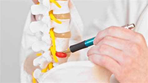 What Is The Difference Between A Bulging Disc And Herniated Disc Precision Spine Care