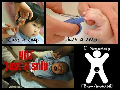 Circumcision Not Just A Snip Circumcision Attachment Parenting
