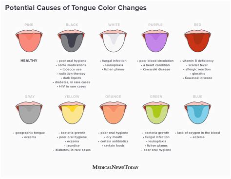 What Your Tongue Colour May Reveal About Your Health Daily Infographic
