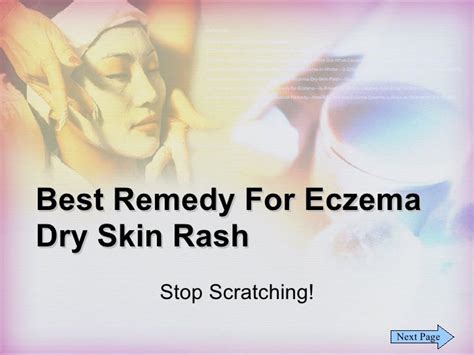 Best Remedy For Eczema Dry Skin Rash Stop Scratching