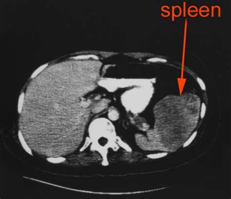 Gastrointestinal Radiology