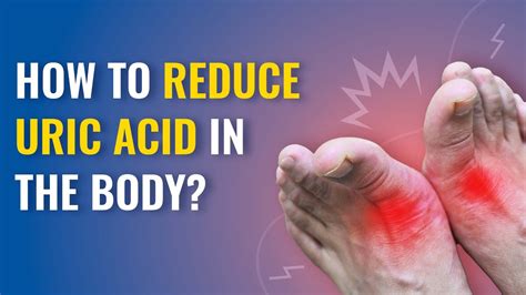 Uric Acid Symptoms And Treatment How To Reduce Uric Acid In The Body