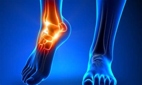 Ankle Fracture Treatment In Pune Dr Chetan Oswal