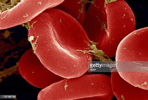 Red Blood Cell Micrograph Photos And Premium High Res Pictures Getty