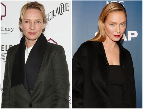 Did Uma Thurman Get Plastic Surgery See Her Face
