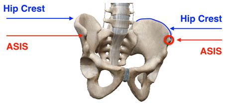 Anterior Pelvic Bone Anatomy