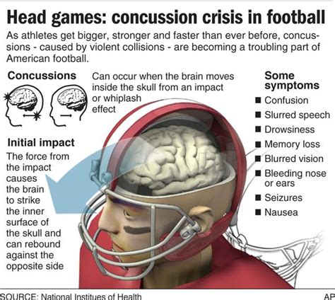‘concussion’ And What You Should Know About Sports And Brain Injuries Local News