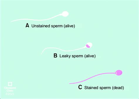 Schematic Representation Of Alive A B And Dead Sperm C After Download Scientific Diagram