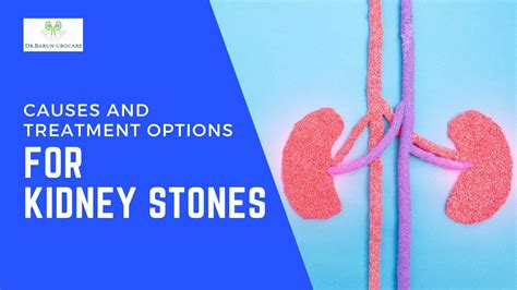 Causes And Treatment Options For Kidney Stones Dr Barun Kumar