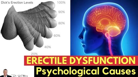 Psychological Causes Of Erectile Dysfunction All About Sexual Dysfunction