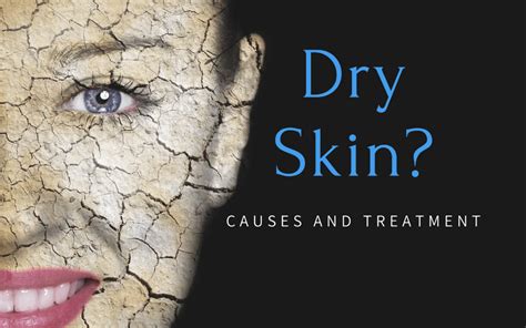 The Common Causes Of Dry Skin And How To Treat It Associated