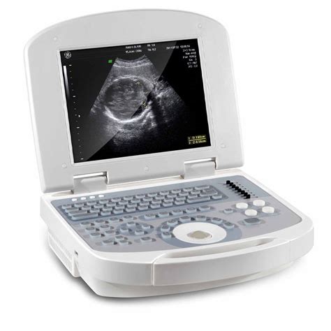 Probe Ultrasound Machine Portable Ultrasound Scanner Doppler Color