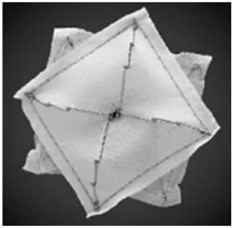 Asd device closure is one of the earliest device closures. Full text Current perspectives in percutaneous atrial ...