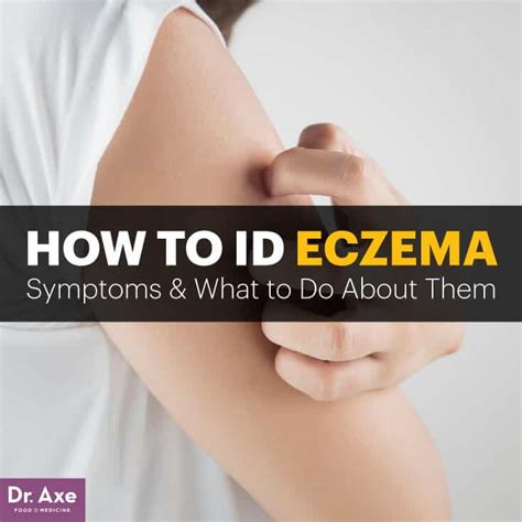 What Are Eczema Symptoms Plus 5 Natural Treatments Dr Axe