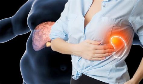 Non Alcoholic Fatty Liver Disease Symptoms Include Right Upper