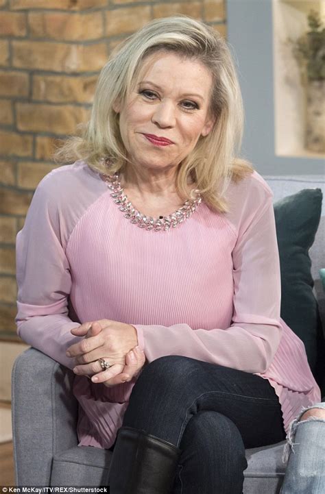 Shamelss Tina Malone Ditches Make Up Following Cosmetic Surgery