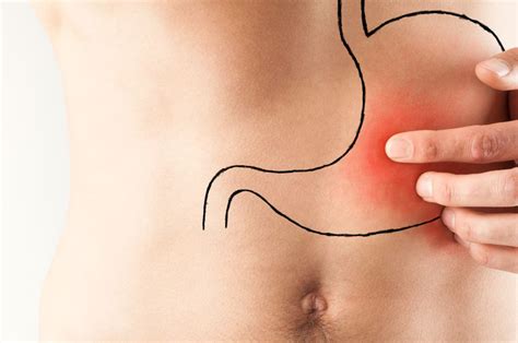 O que é gastrite crônica Conheça os sintomas e tratamentos Osasco Notícias